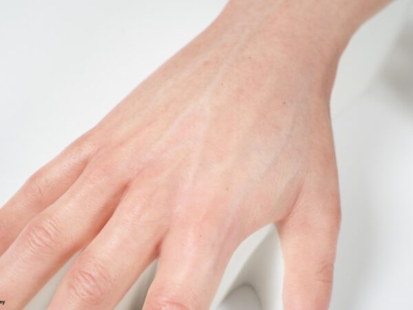 Injektionstrainer Hand mit simulierter Blutzirkulation - Image 2