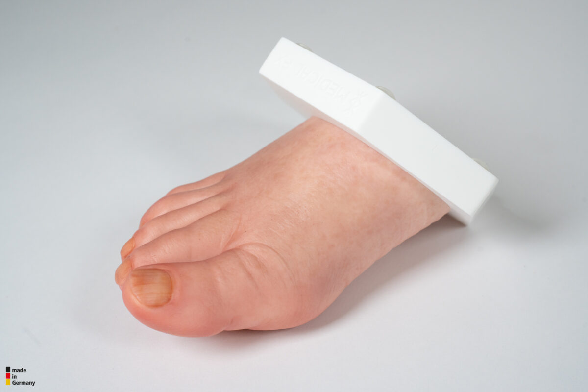 Base Model Diabetic Foot Ulcer (DFU), Stage 3, Forefoot