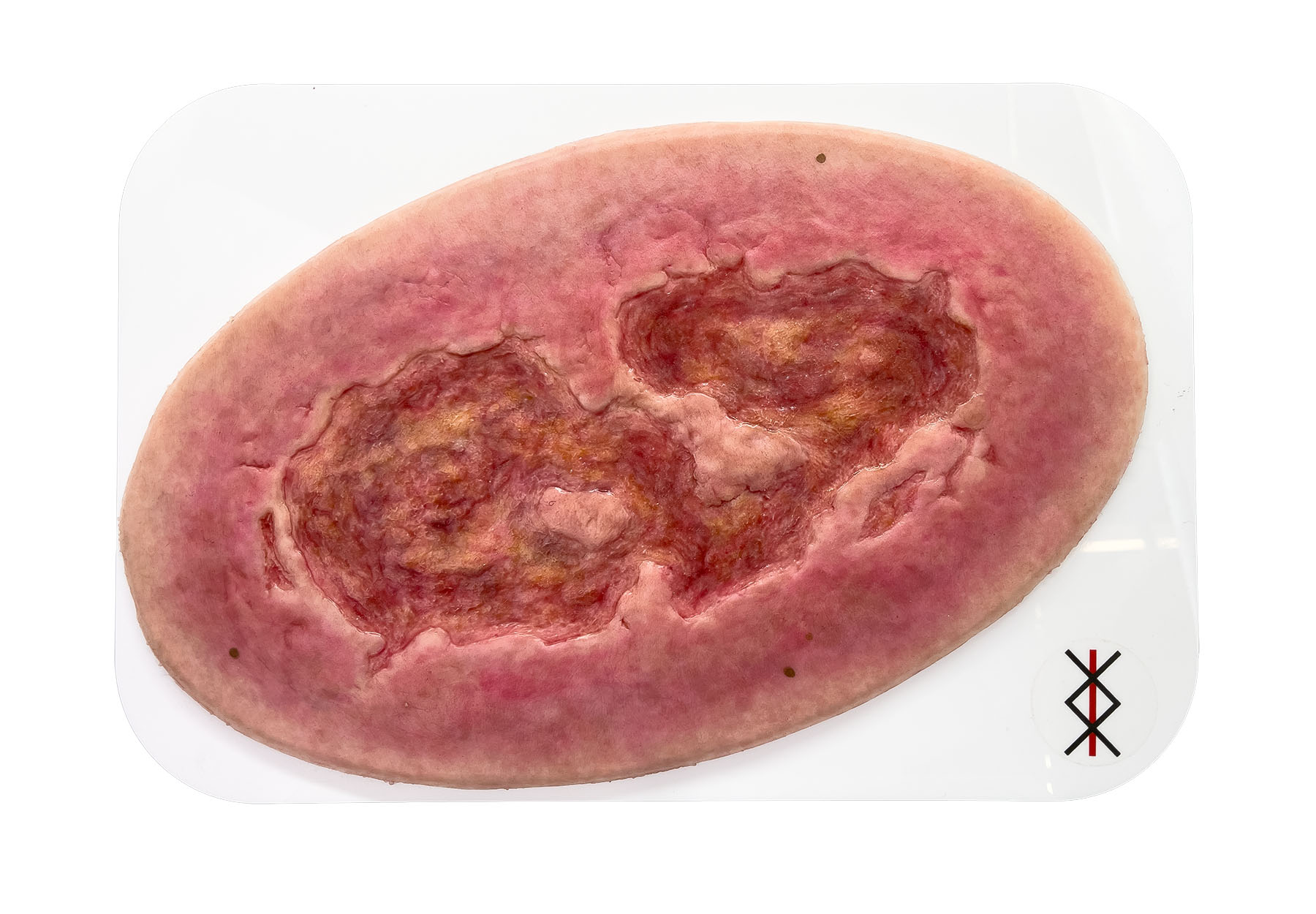 Stick-On Large Ulcus Cruris – Bild 1