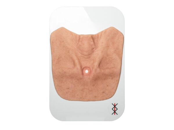 Stick-On Large Tracheostoma