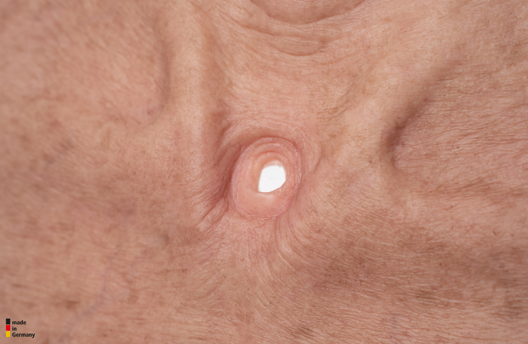 Stick-On Large Tracheostoma (Luftröhrenschnitt) – Bild 2