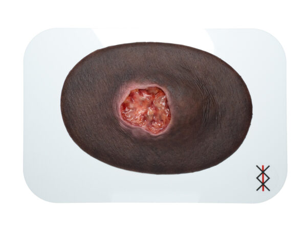 Stick-On Medium escarre stade 3 - Image 12