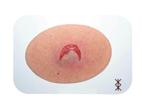 Stick-On Medium Skin Tears