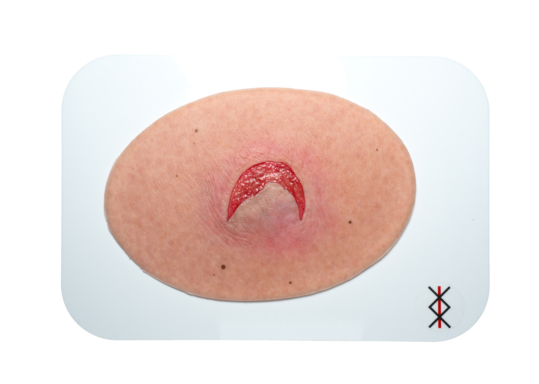 Stick-On Medium Offene Ablederung (Skin tears) – Bild 1