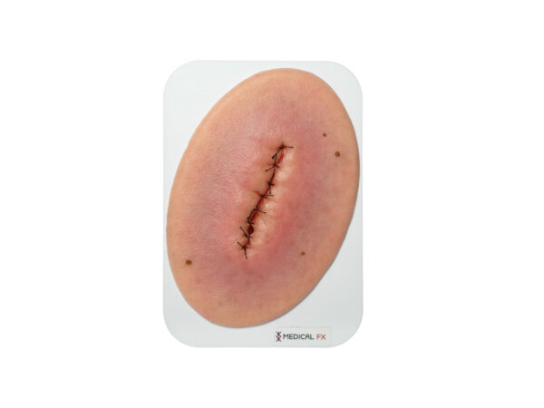 Stick-On Small 봉합되고 염증이 있는 수술 상처
