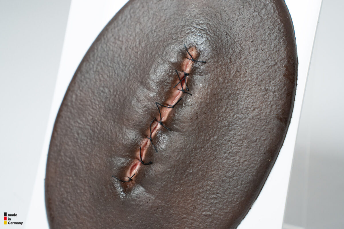 Stick-On Small OP-Wunde geschlossen und entzündet