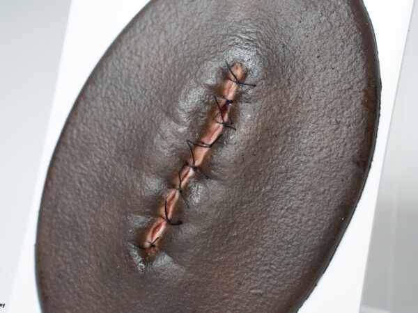 Stick-On Small OP-Wunde geschlossen und entzündet – Bild 4