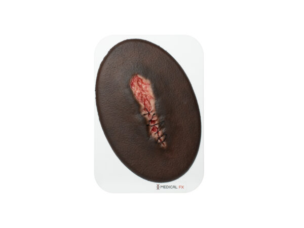 Stick-On Small OP-Wunde geöffnet – Bild 5