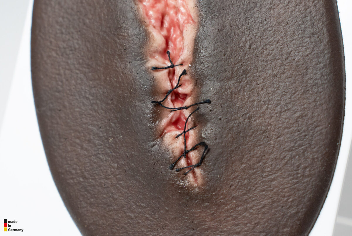 Stick-On Small OP-Wunde geöffnet