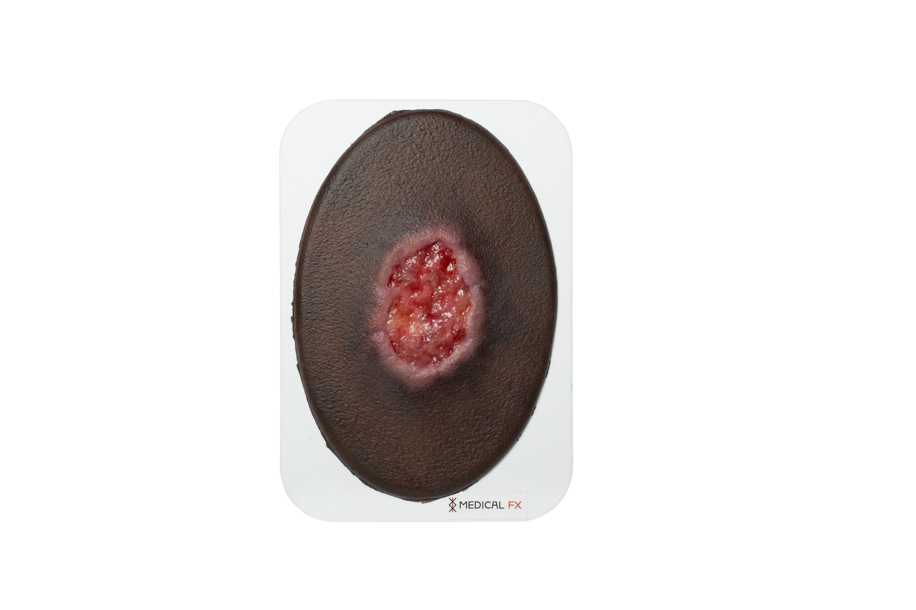 Stick-On Small Dekubitus Grad 3 – Bild 7