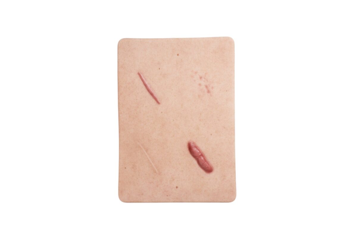 Tabletwunde 4 Narbenmodell Keloide Narbe, Atrophe Narbe, Normale Narbe, Hypertrophe Narbe