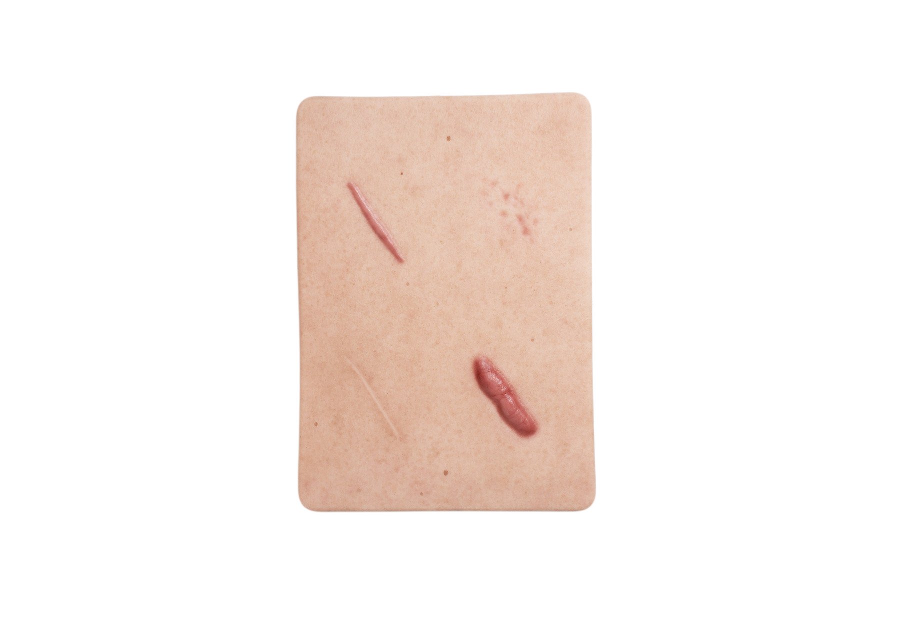 Tabletwunde 4 Narbenmodell Keloide Narbe, Atrophe Narbe, Normale Narbe, Hypertrophe Narbe – Bild 2