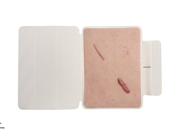 Tabletwunde 4 Narbenmodell Keloide Narbe, Atrophe Narbe, Normale Narbe, Hypertrophe Narbe