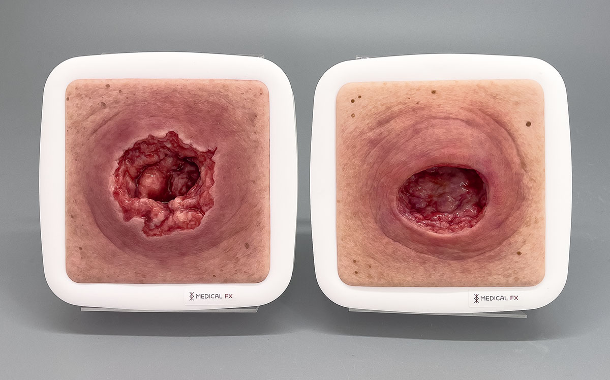 15% RABATT DEKUBITUS SPECIAL