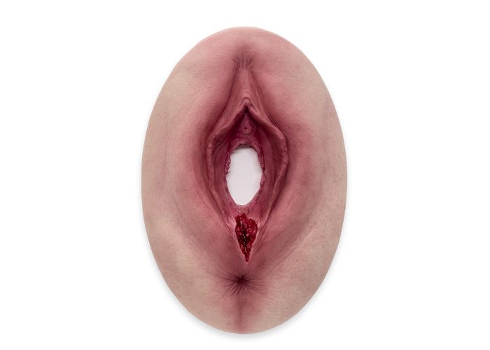 STM-11-0074-00-Dammriss-2-Grades-MEDICALFX-GERMANY-REALISTIS-WOUND-MODELS-silicone