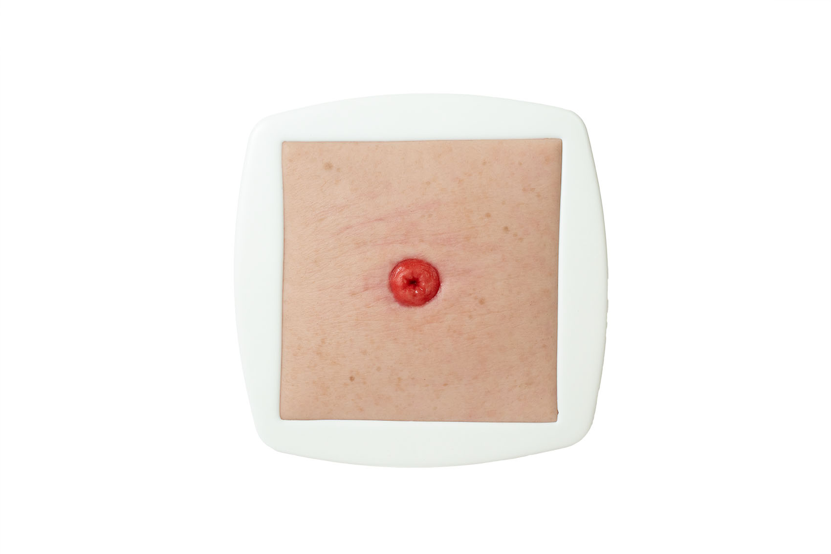 Frame Model Estoma a Nivel de Piel - Image 1