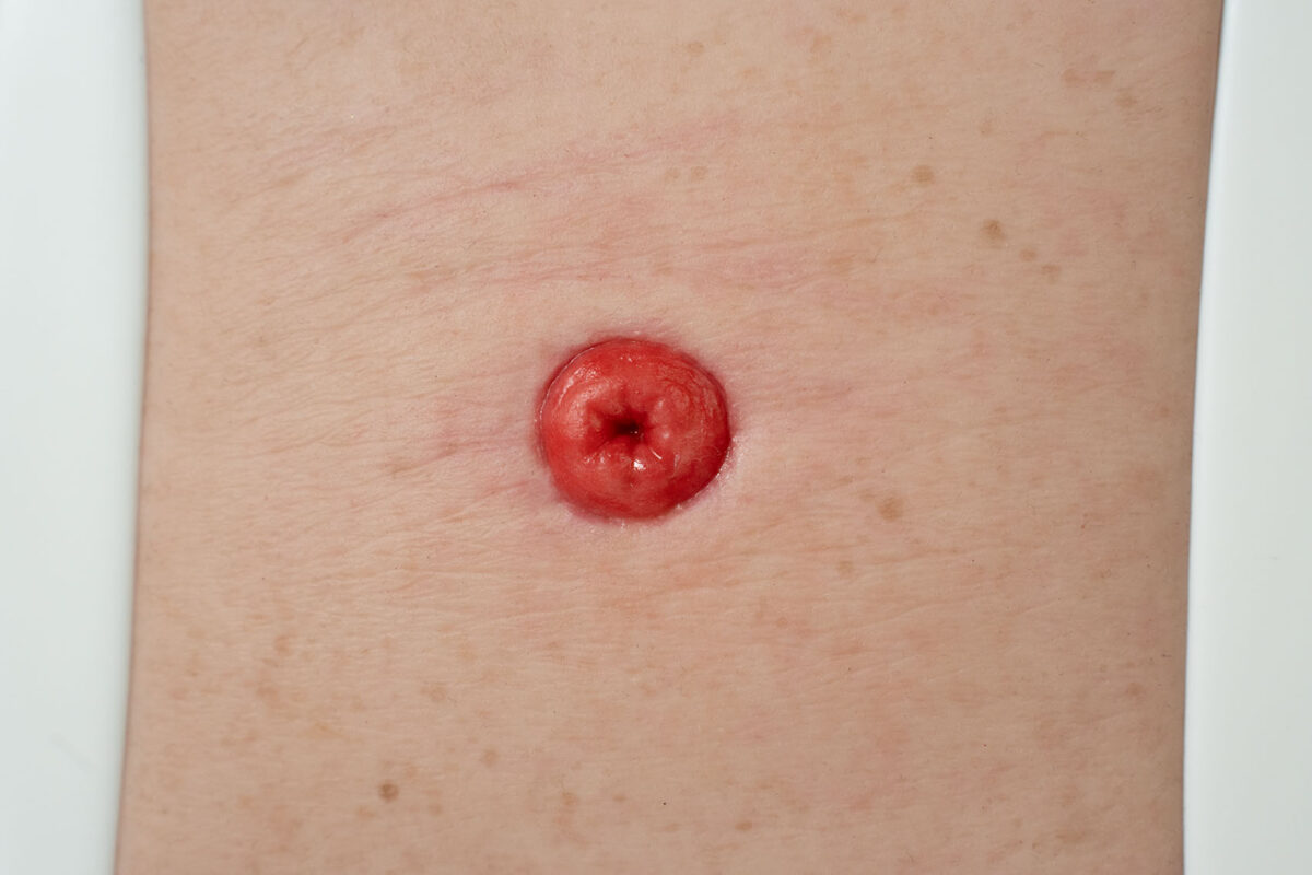 Frame Model Estoma a Nivel de Piel