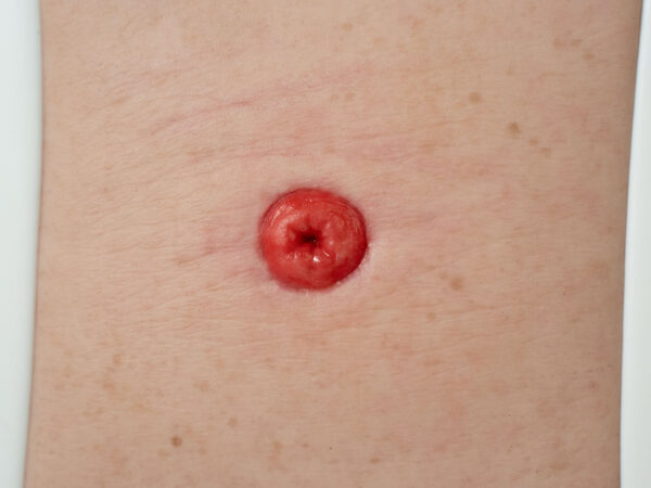 Frame Model Estoma a Nivel de Piel - Image 2