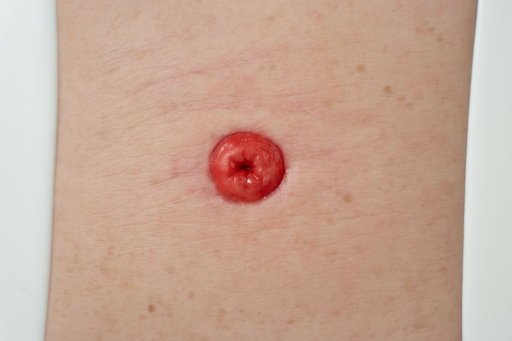 Frame Model Estoma a Nivel de Piel - Image 2